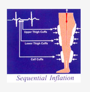 Sequential Inflation 