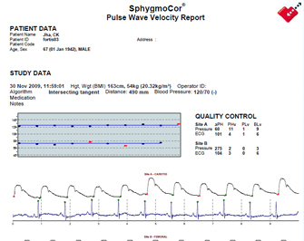 SphygmoCor Report