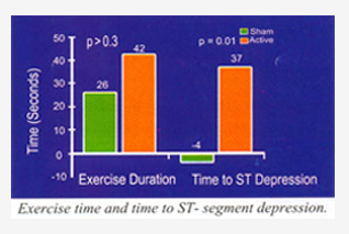 Exercise time and time to ST-segment depression